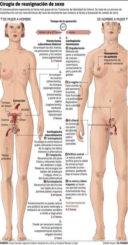 cirugia transgenero