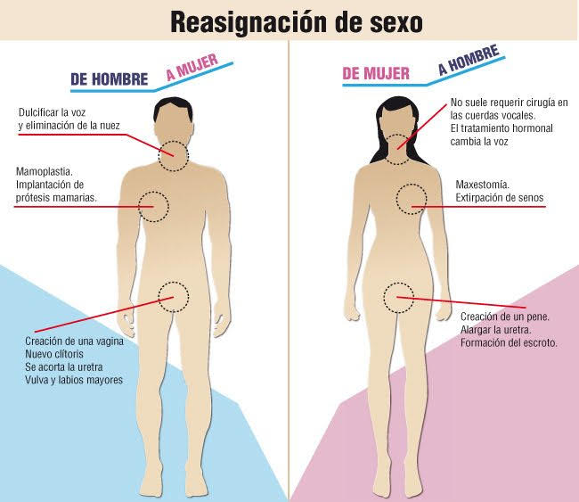 reasignacion de sexo